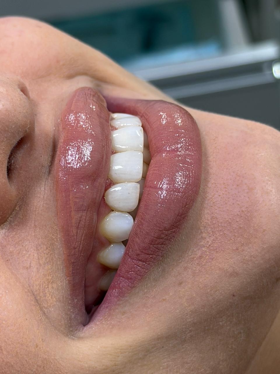 Design de Sorriso (DSD)